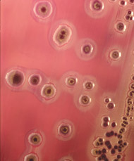 Coliform Bacteria